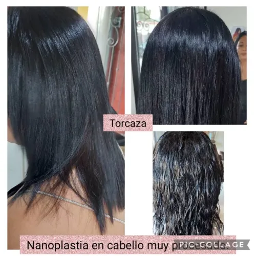 Estética Torcaza
