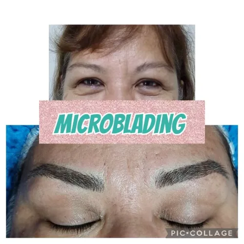Estética Torcaza