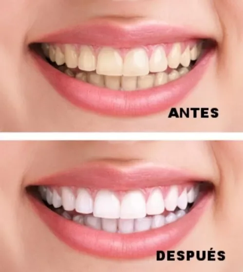 Clinica Dental San Francisco