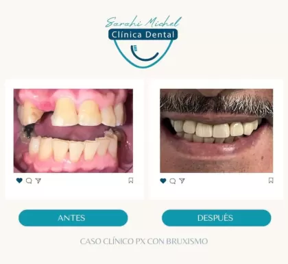 Clinica Dental Sarahi Michel