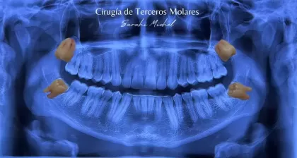 Clinica Dental Sarahi Michel